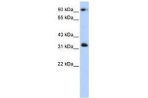 Image no. 1 for anti-Coiled-Coil Domain Containing 69 (CCDC69) (C-Term) antibody (ABIN6741306) (CCDC69 antibody  (C-Term))