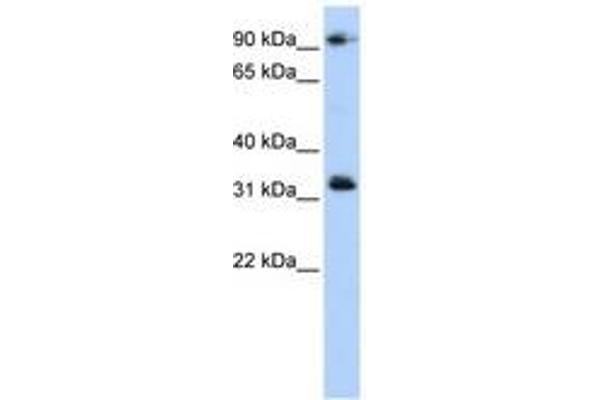 CCDC69 antibody  (C-Term)