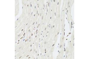 Immunohistochemistry (Paraffin-embedded Sections) (IHC (p)) image for anti-X-Ray Repair Complementing Defective Repair in Chinese Hamster Cells 6 (XRCC6) (AA 500-600) antibody (ABIN1513143)