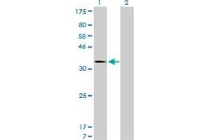 Western Blotting (WB) image for anti-Mdm2, p53 E3 Ubiquitin Protein Ligase Homolog (Mouse) (MDM2) (AA 101-200) antibody (ABIN517806)
