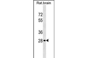 Rat Hoxd9 Antibody (Center) (ABIN1537807 and ABIN2849159) western blot analysis in rat brain tissue lysates (35 μg/lane). (HOXD9 antibody  (AA 127-154))