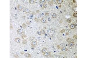 Immunohistochemistry of paraffin-embedded Mouse brain using ATAD3A Polyclonal Antibody at dilution of 1:100 (40x lens). (ATAD3A antibody)