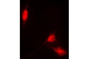 Immunofluorescent analysis of NRF2 staining in HL60 cells. (NRF2 antibody  (C-Term))