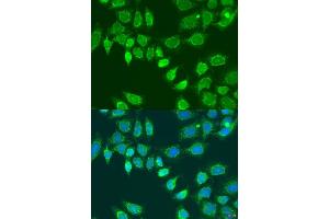 Immunofluorescence analysis of U2OS cells using L2HGDH antibody (ABIN7268160) at dilution of 1:100. (L2HGDH antibody  (AA 1-220))