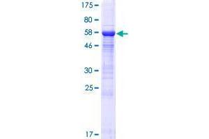 BRMS1L Protein (AA 1-323) (GST tag)