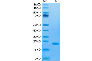 Human CD20 on Tris-Bis PAGE under reduced condition. (CD20 Protein (AA 141-188) (His-Avi Tag))