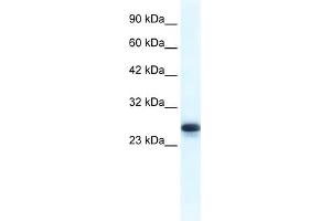 WB Suggested Anti-HMGB1 Antibody Titration:  1. (HMGB1 antibody  (Middle Region))