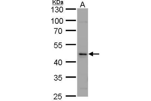 CASQ2 antibody