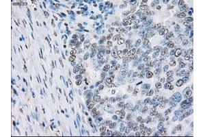 Immunohistochemical staining of paraffin-embedded Kidney tissue using anti-PSMA7mouse monoclonal antibody.