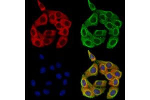 CHL1 Antibody staining Hela cells by IF/ICC.