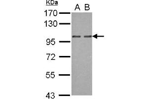Western Blotting (WB) image for anti-Oxysterol Binding Protein 2 (OSBP2) (AA 596-835) antibody (ABIN1499917)