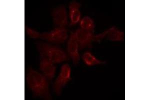 ABIN6275289 staining Hela by IF/ICC. (Nesprin3 antibody  (N-Term))