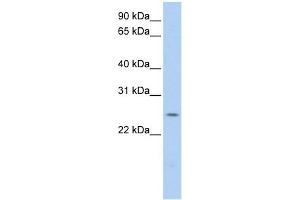 PARK7 antibody used at 1 ug/ml to detect target protein. (PARK7/DJ1 antibody)