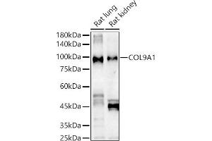 Western blot analysis of extracts of various cell lines, using COL9 Rabbit pAb antibody (ABIN6127648, ABIN6138849, ABIN6138851 and ABIN6222235) at 1:1000 dilution. (COL9A1 antibody  (AA 20-270))