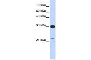 Western Blotting (WB) image for anti-TP53 Target 5 (TP53TG5) antibody (ABIN2459705) (TP53TG5 antibody)