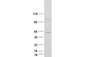 Validation with Western Blot (CSRP2BP Protein (Transcript Variant 2) (Myc-DYKDDDDK Tag))