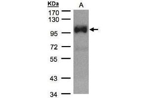WB Image Sample(30 μg of whole cell lysate) A:HeLa S3, 7. (TRPC6 antibody  (C-Term))