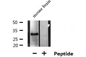 Western blot analysis of extracts from Mouse brain lysate, using MTAP antibody. (MTAP antibody  (Internal Region))