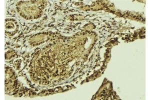 ABIN6269152 at 1/100 staining Mouse colon tissue by IHC-P. (ATF2 antibody  (N-Term))