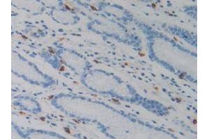 IHC-P analysis of Human Stomach Tissue, with DAB staining. (Resistin antibody  (AA 17-108))