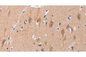 Immunohistochemistry of paraffin-embedded Human brain using OTUB1 Polyclonal Antibody at dilution of 1:40 (OTUB1 antibody)