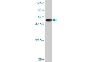 Western Blot detection against Immunogen (47. (BID antibody  (AA 1-195))