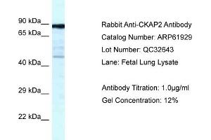 Western Blotting (WB) image for anti-Cytoskeleton Associated Protein 2 (CKAP2) (C-Term) antibody (ABIN2788952) (CKAP2 antibody  (C-Term))