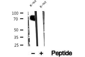 Western blot analysis of extracts of K-562 cells, using CMIP antibody. (CMIP antibody  (C-Term))