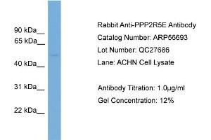 Western Blotting (WB) image for anti-Protein Phosphatase 2, Regulatory Subunit B', epsilon Isoform (PPP2R5E) (N-Term) antibody (ABIN2786846) (PPP2R5E antibody  (N-Term))