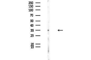 anti-Melanoma Antigen Family B, 5 (MAGEB5) (N-Term) antibody