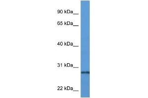 Western Blot showing PRTN3 antibody used at a concentration of 1 ug/ml against Fetal Lung Lysate (PRTN3 antibody  (N-Term))