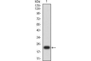 Western blot analysis using BRIP1 mAb against human BRIP1 (AA: 904-986) recombinant protein. (BRIP1 antibody  (AA 904-986))