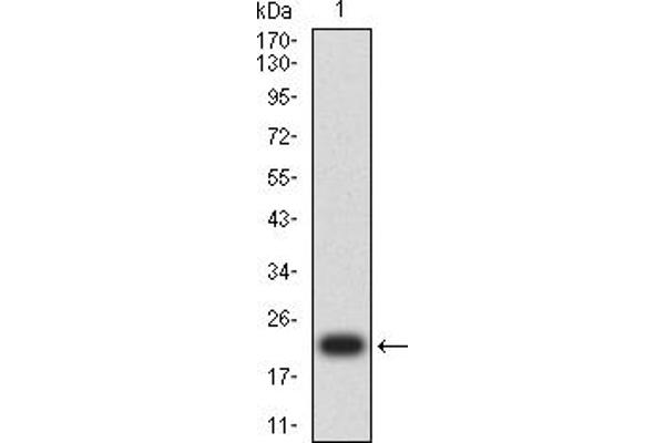 BRIP1 anticorps  (AA 904-986)