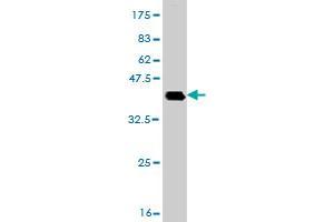 Western Blot detection against Immunogen (36. (DHX8 antibody  (AA 301-400))