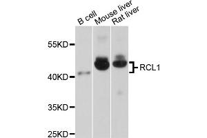 Western blot analysis of extracts of various cell lines, using RCL1 antibody (ABIN1875879) at 1:1000 dilution.