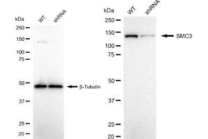 Western blotting analysis using SMC3 antibody (ABIN7800448). (Recombinant SMC3 antibody)