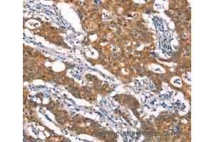 Immunohistochemistry of Human brain  using CYLD Polyclonal Antibody at dilution of 1:35
