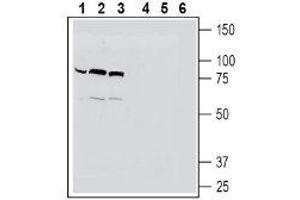 Western blot analysis of human THP-1 monocytic leukemia cell line lysates (lanes 1 and 4), mouse BV-2 microglia cell line lysates (lanes 2 and 5) and human HeLa cervix adenocarcinoma cell line lysates (lanes 3 and 6): - 1-3. (SLC22A4 antibody  (C-Term, Intracellular))