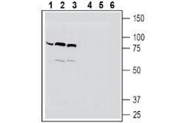 SLC22A4 抗体  (C-Term, Intracellular)