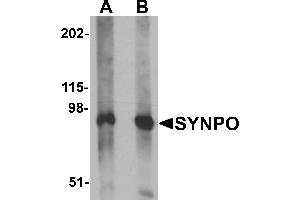 Western Blotting (WB) image for anti-Synaptopodin (SYNPO) (C-Term) antibody (ABIN1030717) (SYNPO antibody  (C-Term))