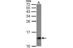 WB Image Sample (30 ug of whole cell lysate) A: A549 15% SDS PAGE antibody diluted at 1:1000 (Ensa antibody)