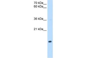 Western Blotting (WB) image for anti-NADH Dehydrogenase (Ubiquinone) 1 beta Subcomplex, 5, 16kDa (NDUFB5) antibody (ABIN2462840)