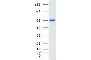 Western Blotting (WB) image for Ribosomal Protein S6 Kinase, 70kDa, Polypeptide 1 (RPS6KB1) protein (Myc-DYKDDDDK Tag) (ABIN2731182)