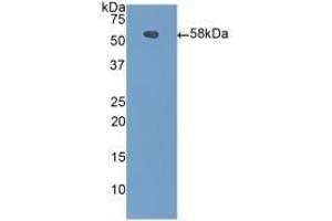 Detection of Recombinant CPN1, Mouse using Polyclonal Antibody to Carboxypeptidase N1 (CPN1)