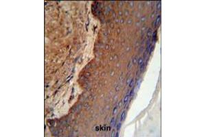KRT9 Antibody (Center K317) IHC analysis in formalin fixed and paraffin embedded skin tissue followed by peroxidase conjugation of the secondary antibody and DAB staining.