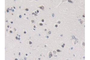 Immunohistochemistry (IHC) image for anti-Heterogeneous Nuclear Ribonucleoprotein A1 (HNRNPA1) (AA 2-372) antibody (ABIN7443554)