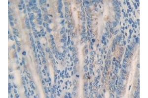 Detection of MGST1 in Mouse Intestine Tissue using Polyclonal Antibody to Microsomal Glutathione S Transferase 1 (MGST1) (MGST1 antibody  (AA 8-155))