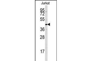 Western blot analysis of anti-PTPN7 Antibody (S44) (ABIN391869 and ABIN2841694) in Jurkat cell line lysates (35 μg/lane). (PTPN7 antibody  (AA 22-51))