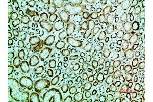 Immunohistochemical analysis of paraffin-embedded human-kidney, antibody was diluted at 1:200 (IRF3 antibody  (AA 1268-1341))