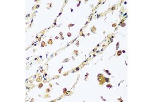 Immunohistochemistry of paraffin-embedded human lung using VPS4A antibody at dilution of 1:100 (40x lens).